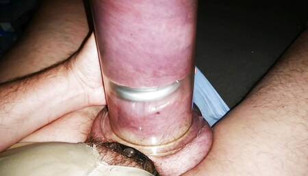 It's Starting with a Finger...