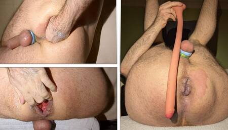 Hard self-fisting and deep penetration attempt