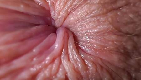 THE NEIGHBOR GIRL IS ALREADY 18 YEARS OLD. Her anus is constantly itchy. What the fuck should I do?