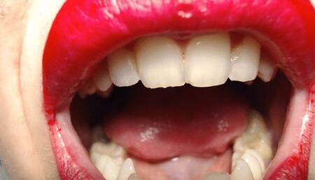 Teeth revange 2