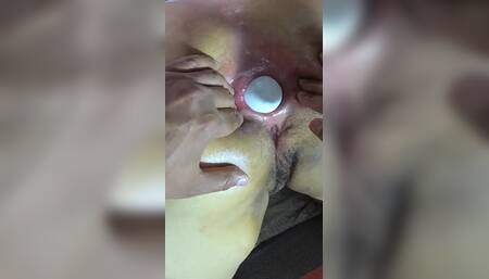 Two Balls, a Giant Dildo and a Fist in Her Ass Hole