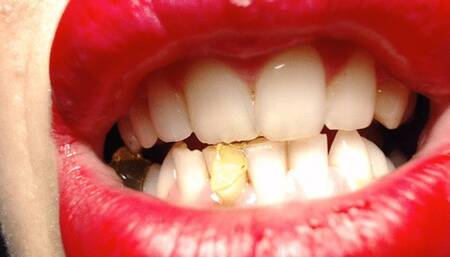 Teeth in action